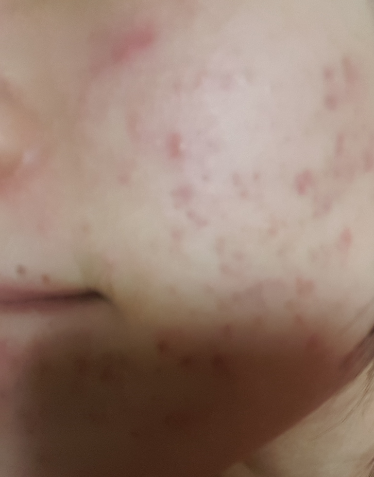 Jeu'Demeure AC 控制温和洁面乳 Plus common.review image