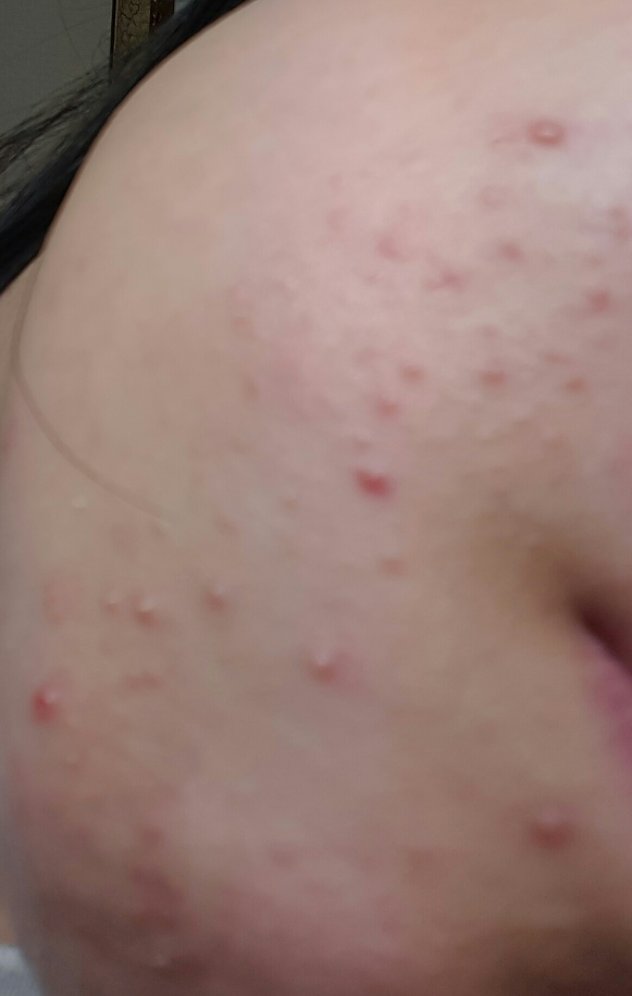 艾克法洁面泡沫的真实用户使用照片
