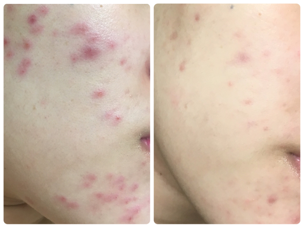 23yearsold Zinc Norcica (inner protection cream) review image