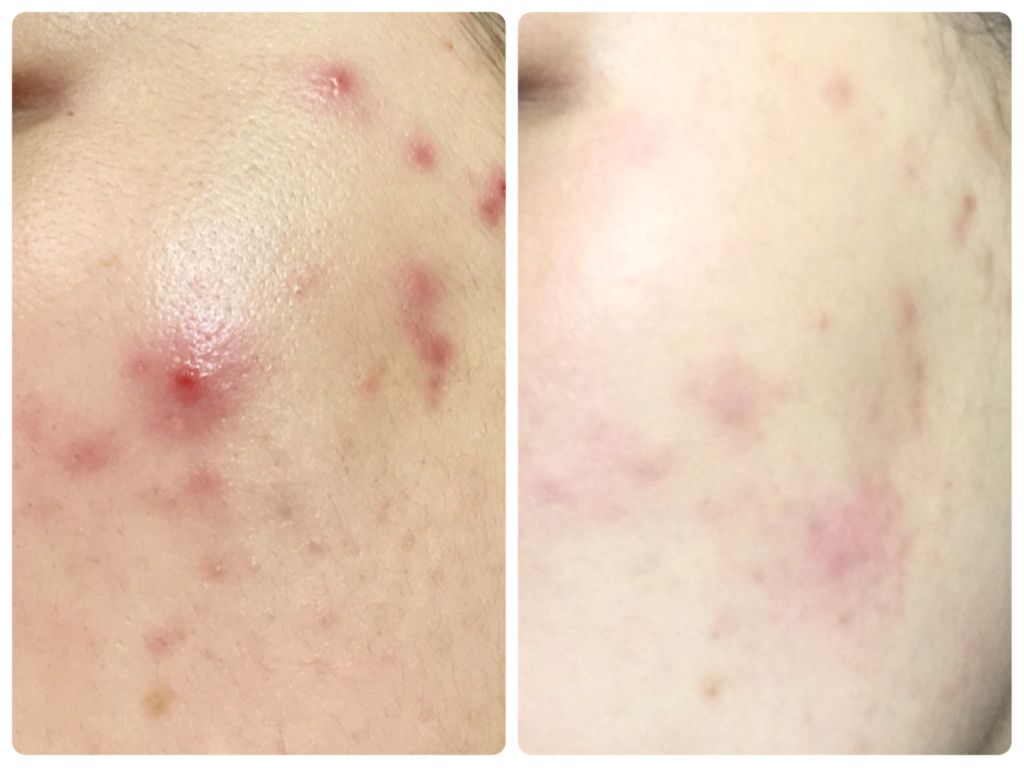 23yearsold Zinc Norcica (inner protection cream) review image