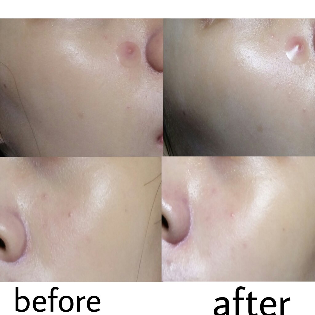 Real user review photo of CC Long Lasting Cushion (Mike) [SPF50+/PA+++] [V103 Pure Beige] (Disney)