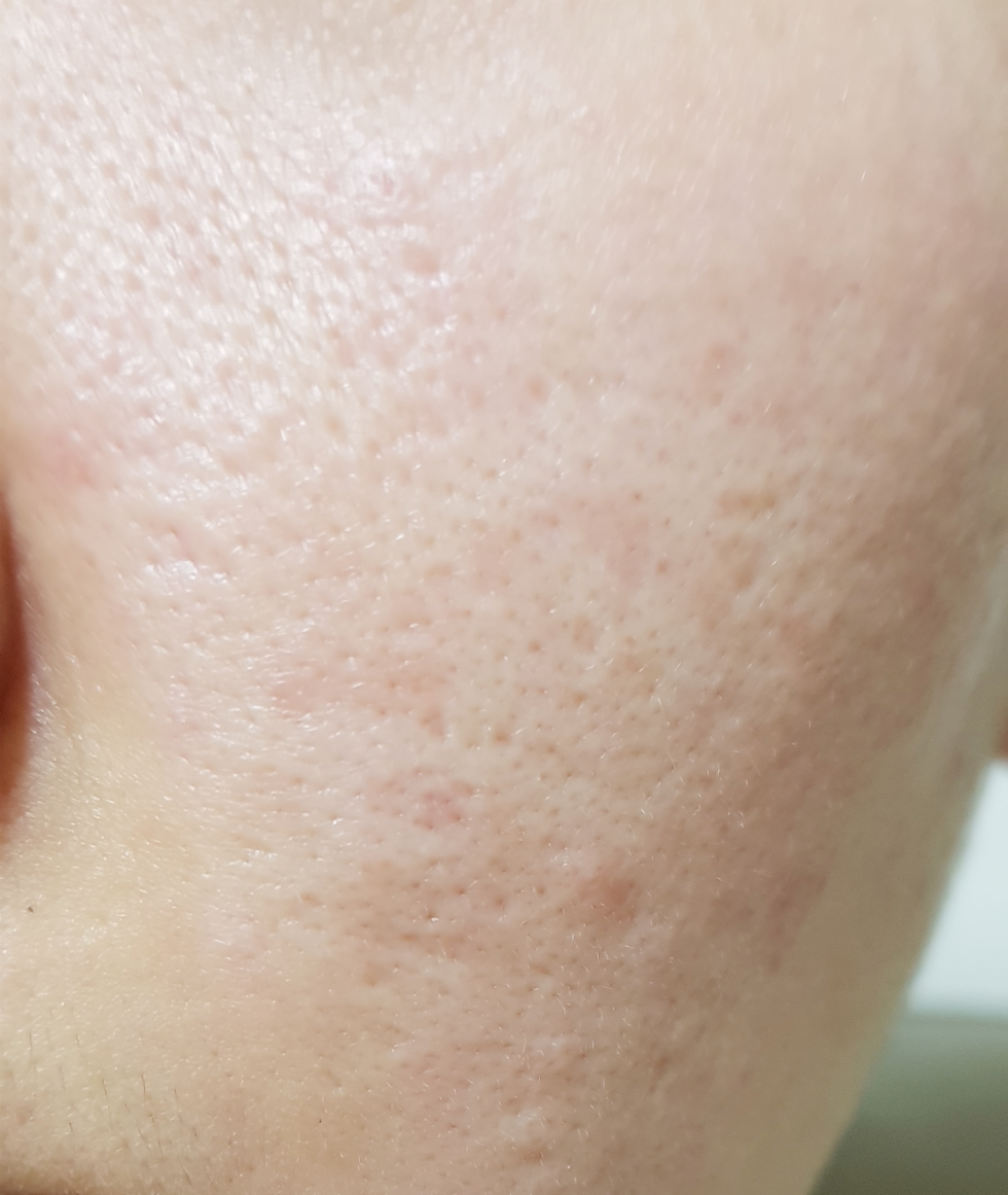 IsNtree Clear Skin AB Peeling Pad review image