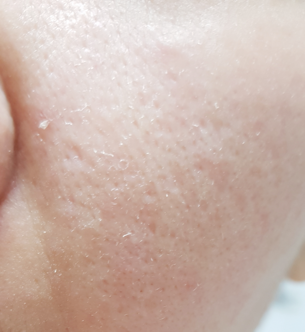 IsNtree Clear Skin AB Peeling Pad review image