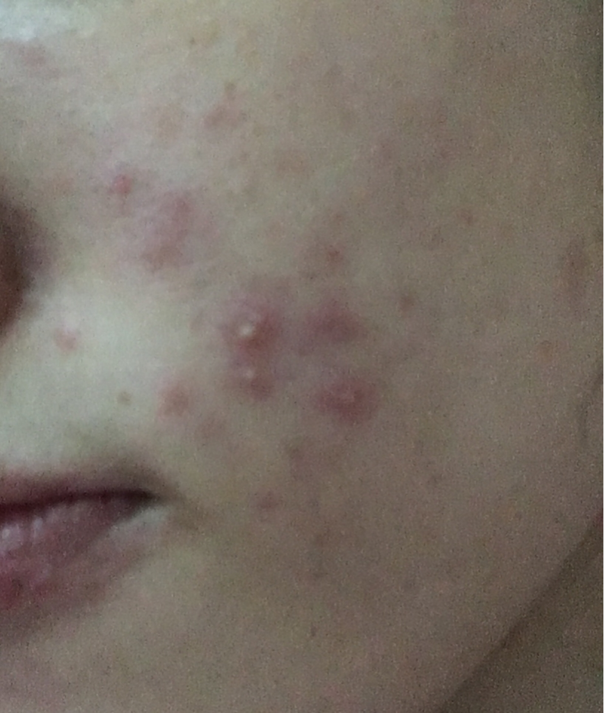 XYZFORMULA Youth Flower Sweet Smooth Essence review image