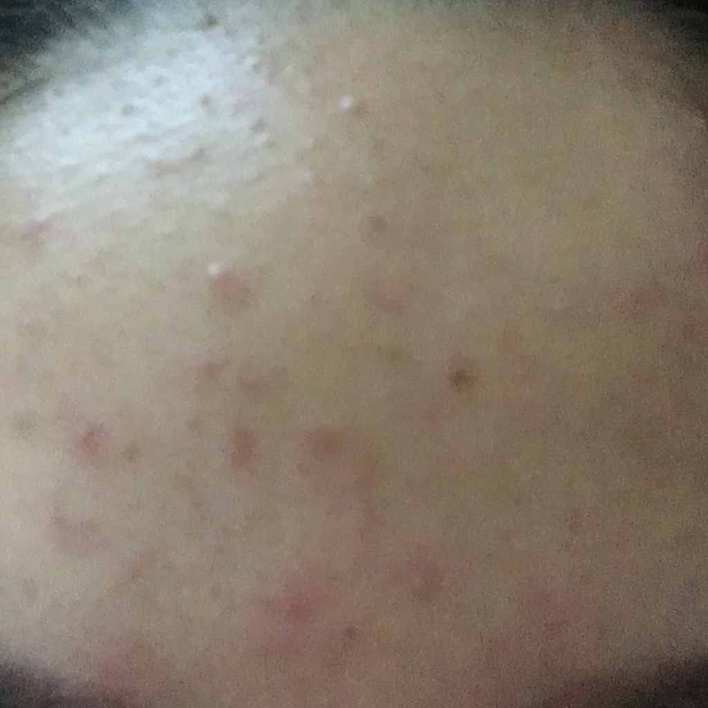XYZFORMULA Youth Flower Sweet Smooth Essence review image