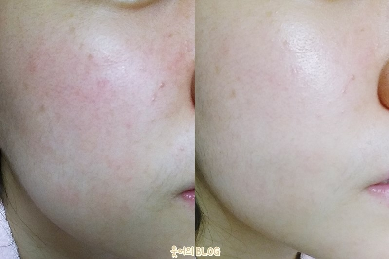 抗衰老保湿霜的真实用户使用照片