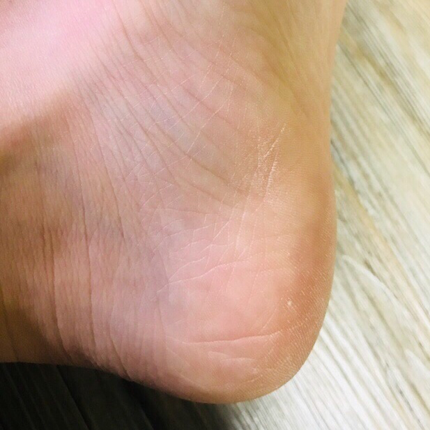 フットケアスティックのリアルなユーザー写真