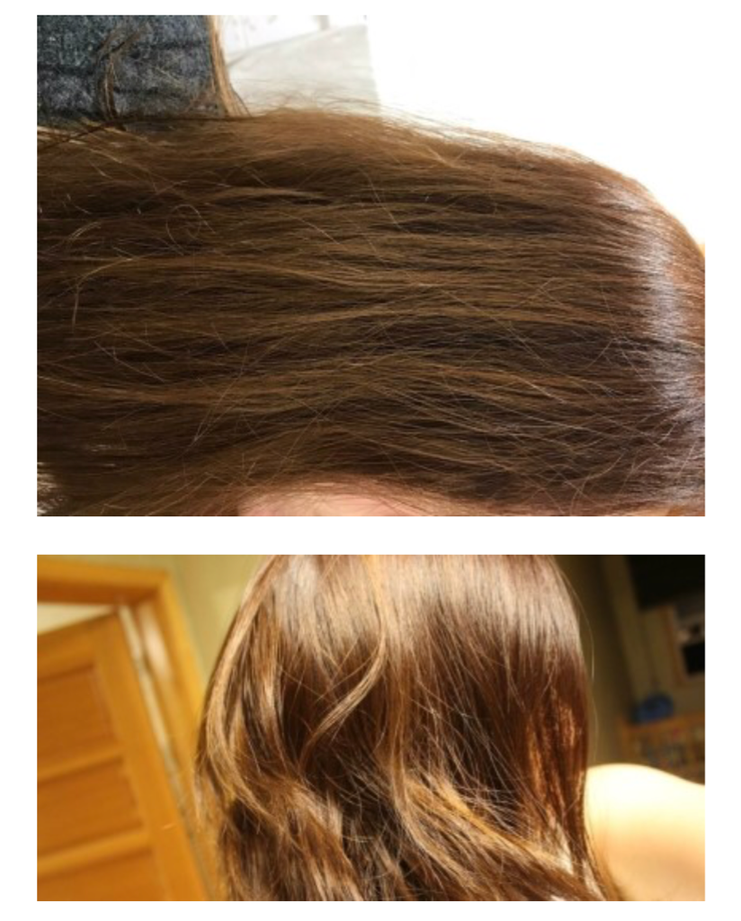 Real user review photo of Baobab LPP Treatment