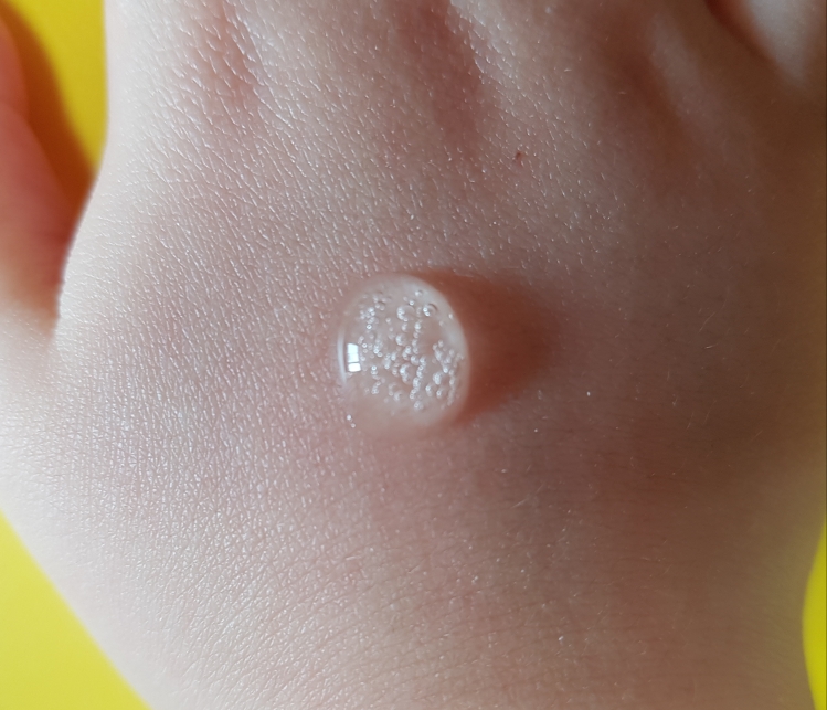 클리브 (CLⅣ) 맥스 히아루로닉 포뮬러 앰플 review image