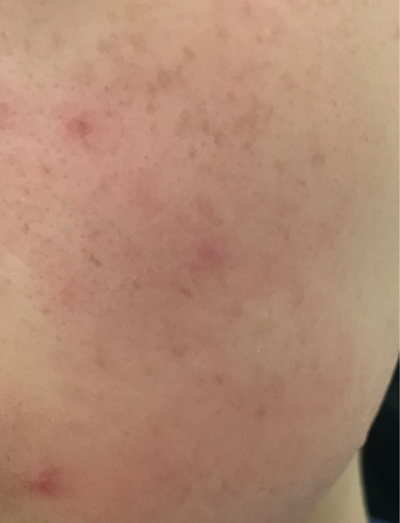 Real user review photo of Atobarrier Intensive Cream
