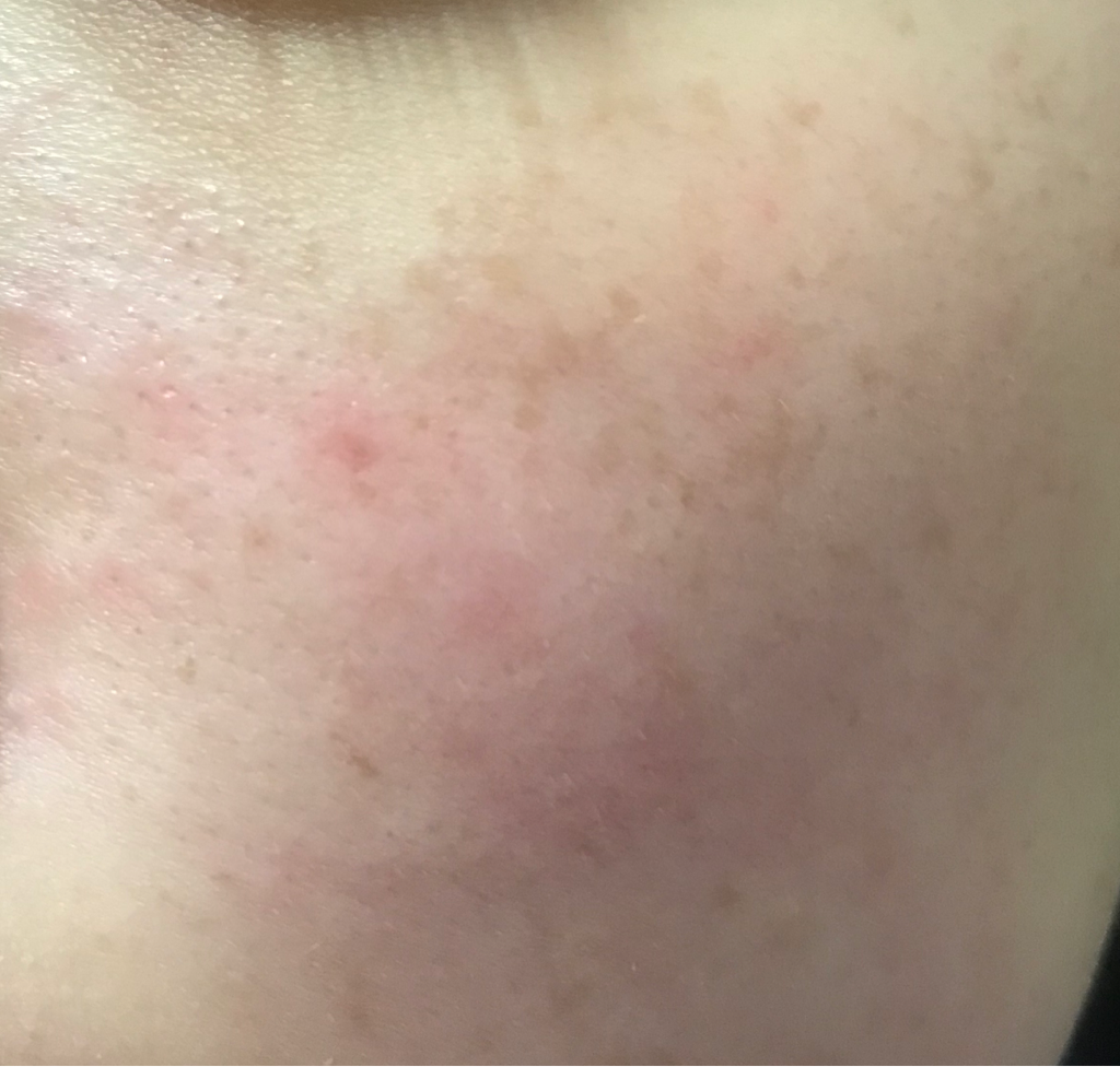 Real user review photo of Atobarrier Intensive Cream