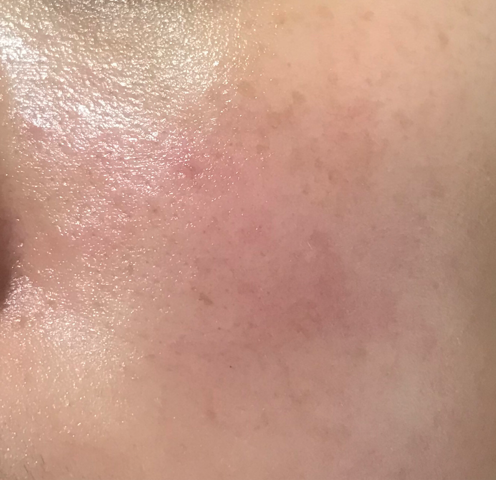 Real user review photo of Atobarrier Intensive Cream