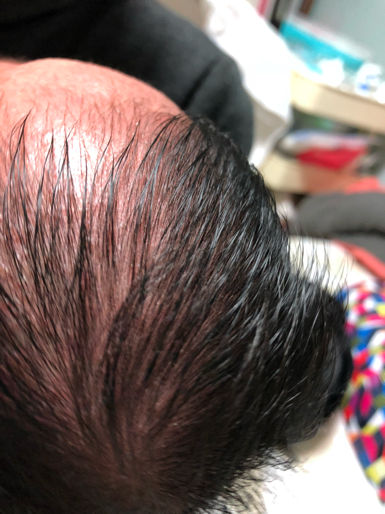 阿托贝内 保湿霜 common.review image