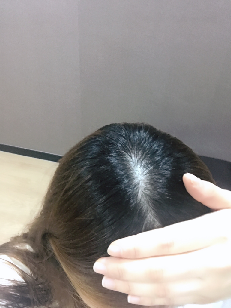Real user review photo of Root Booster S.E Shampoo