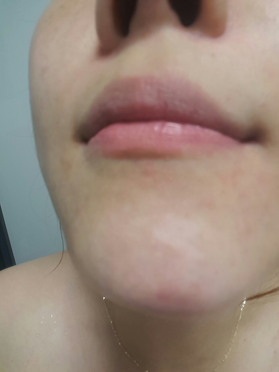 德玛贝斯真实西卡乳霜的真实用户使用照片