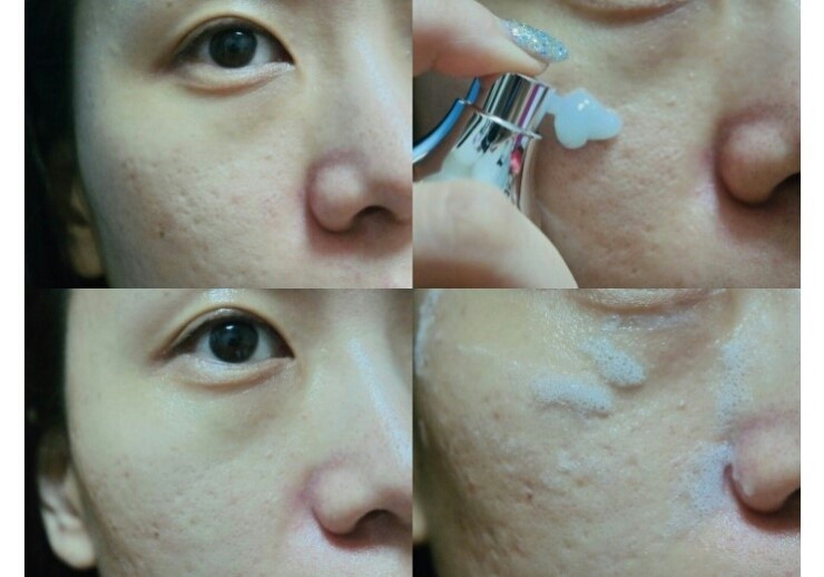 피피엔느 (PIPIENNE) 펩티 골드 버블 에센스 review image