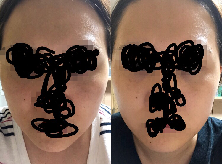 珈拉托克萨德美白霜的真实用户使用照片