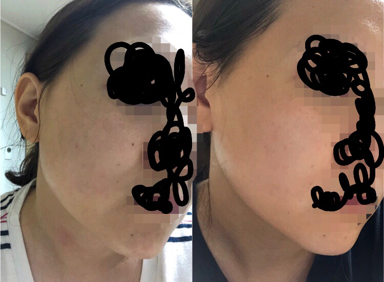 珈拉托克萨德美白霜的真实用户使用照片