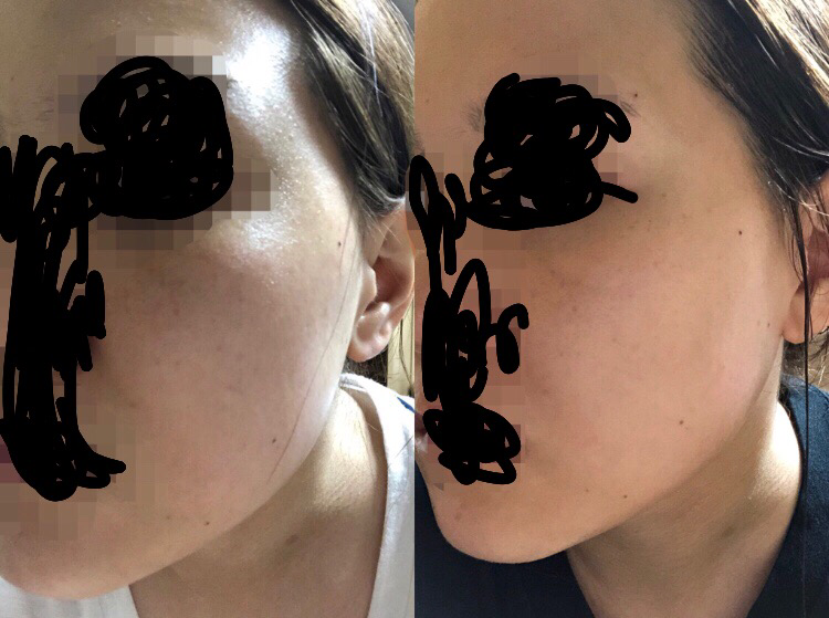 珈拉托克萨德美白霜的真实用户使用照片
