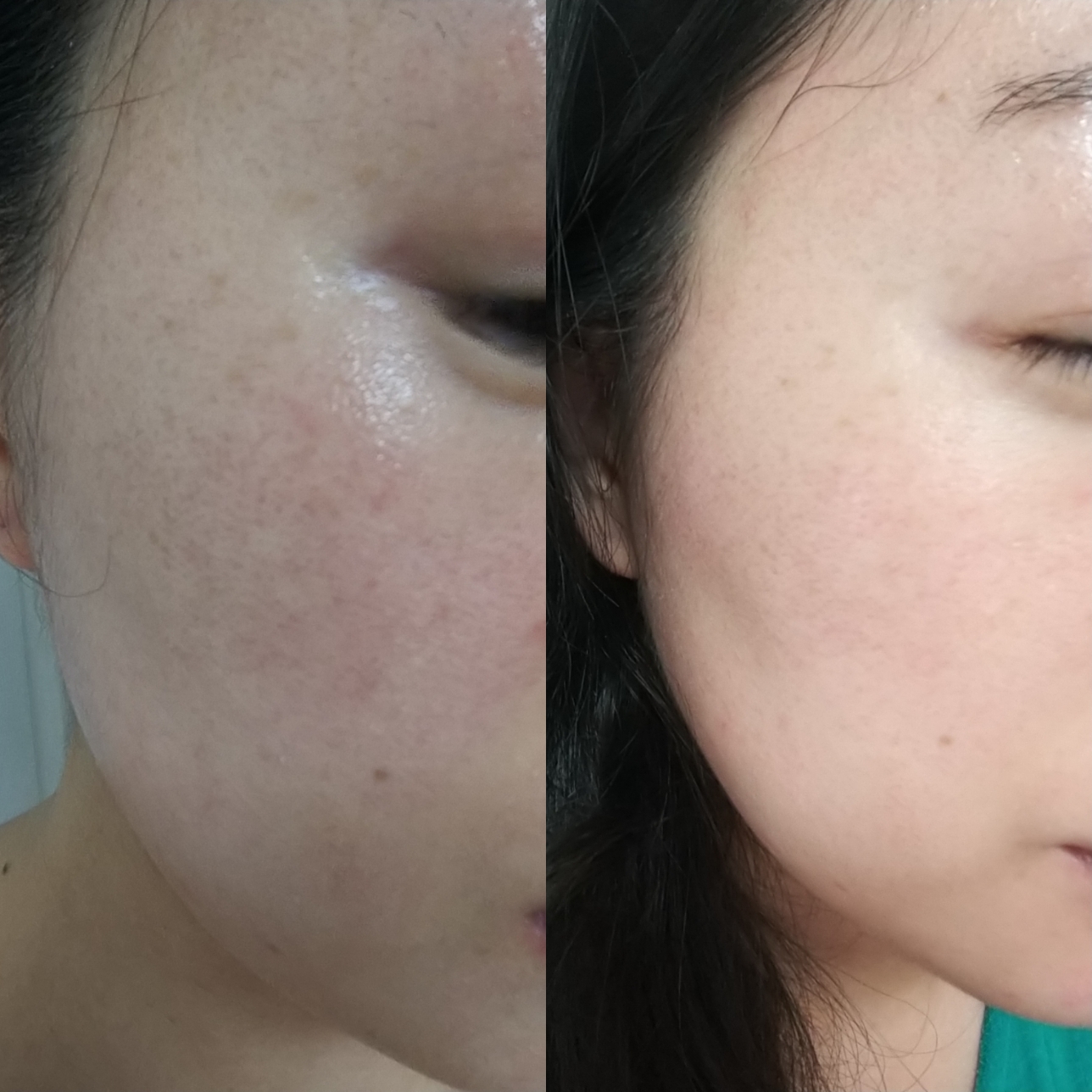 ATOMY Absolute Spot Out Essence review image
