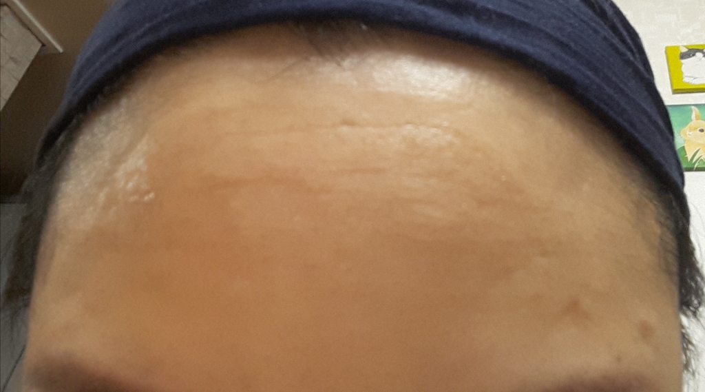 Real user review photo of Wrinkle Power Peeling