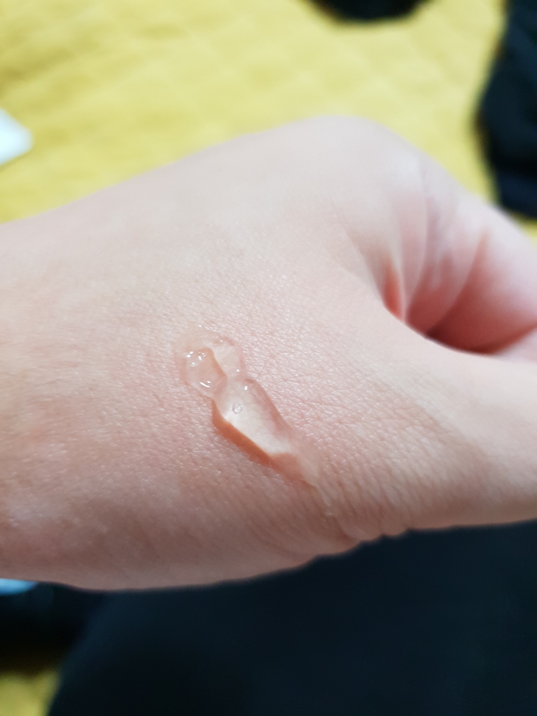 贝贝安宝宝舒缓凝胶的真实用户使用照片