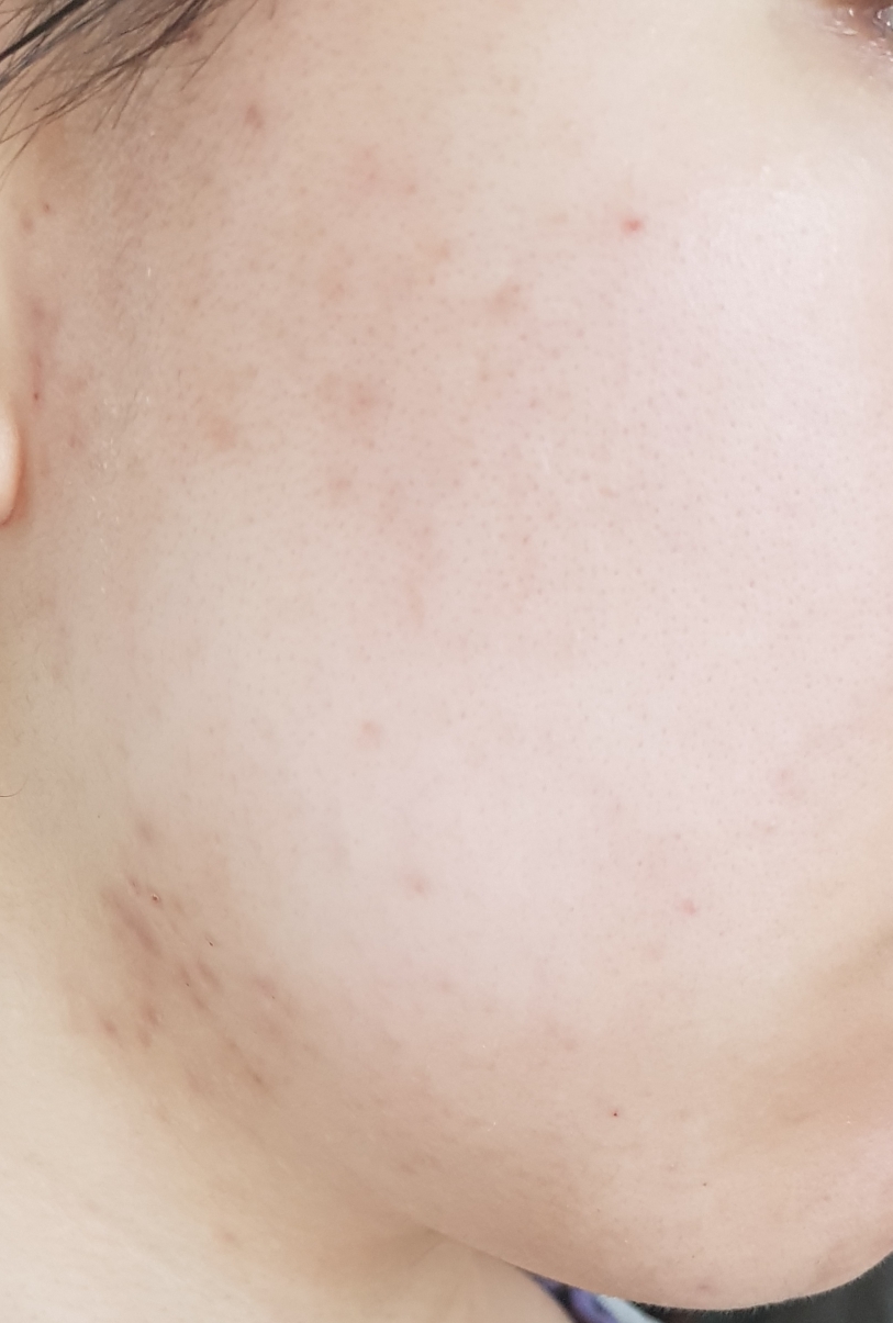 Real user review photo of Teint Idol Ultra Wear Foundation [SPF15] [110C Ivory]
