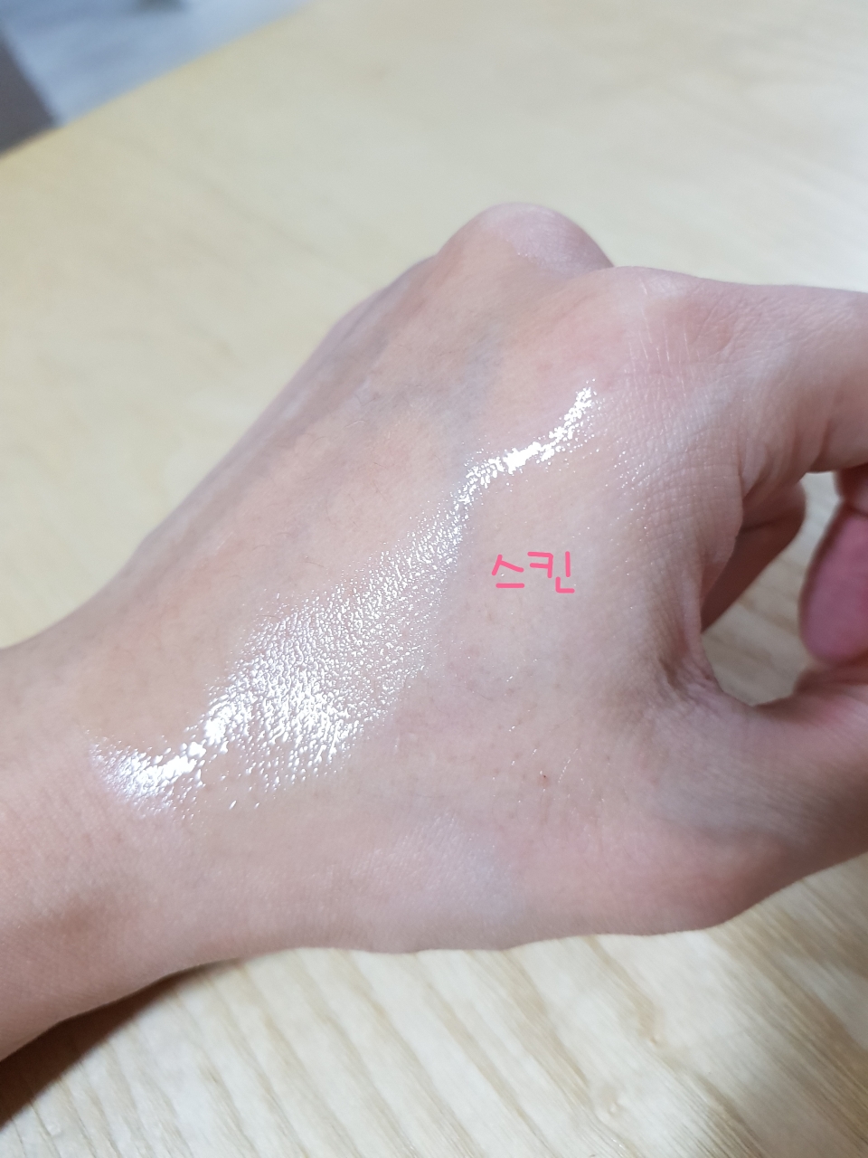 恢复系统皮肤的真实用户使用照片