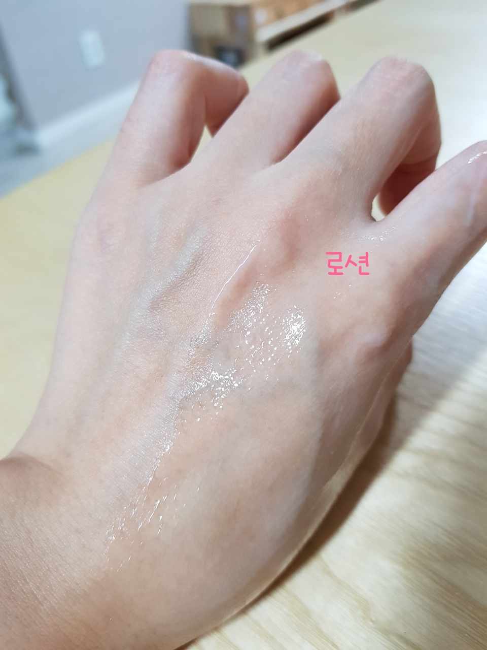 恢复系统皮肤的真实用户使用照片
