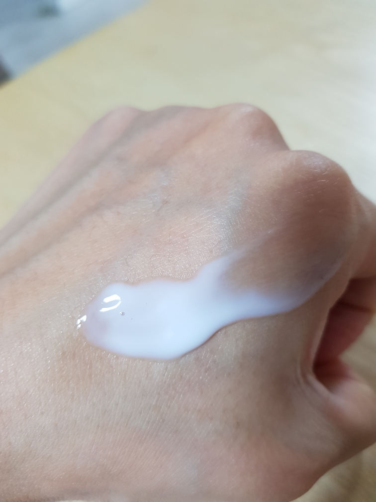 恢复系统皮肤的真实用户使用照片