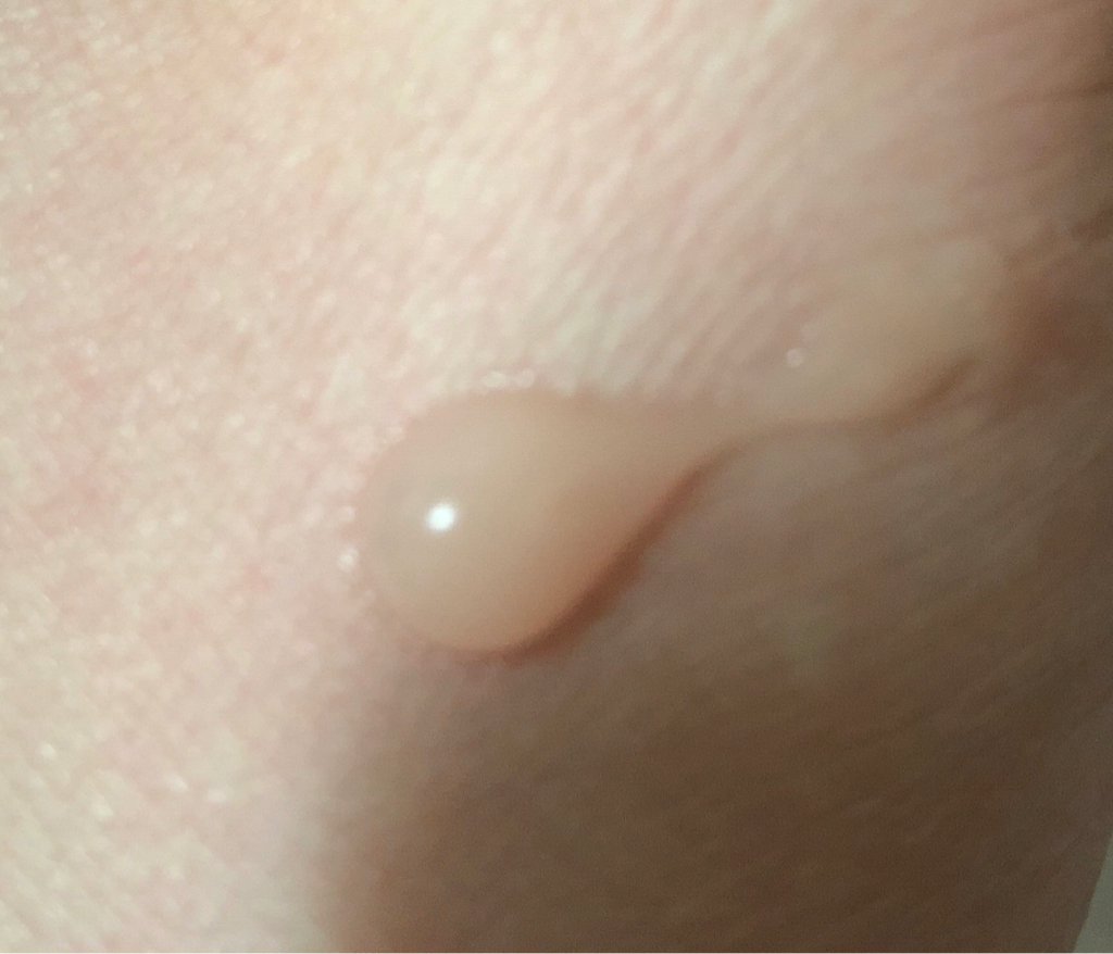 Real user review photo of AC+ All-in-One Magic Cream