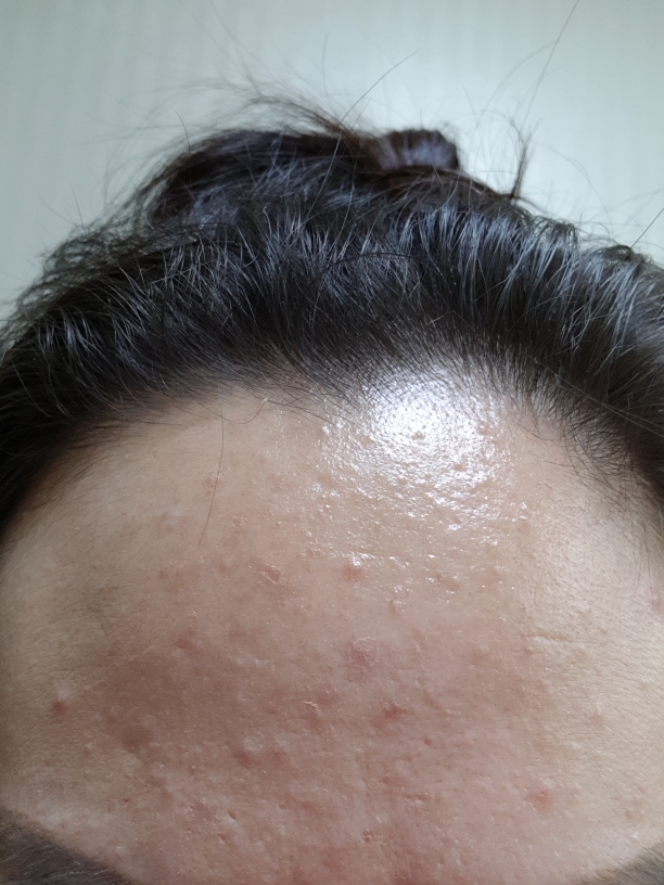 b.glen C Serum review image