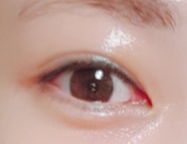 抗浮肿眼部精华啫喱的真实用户使用照片