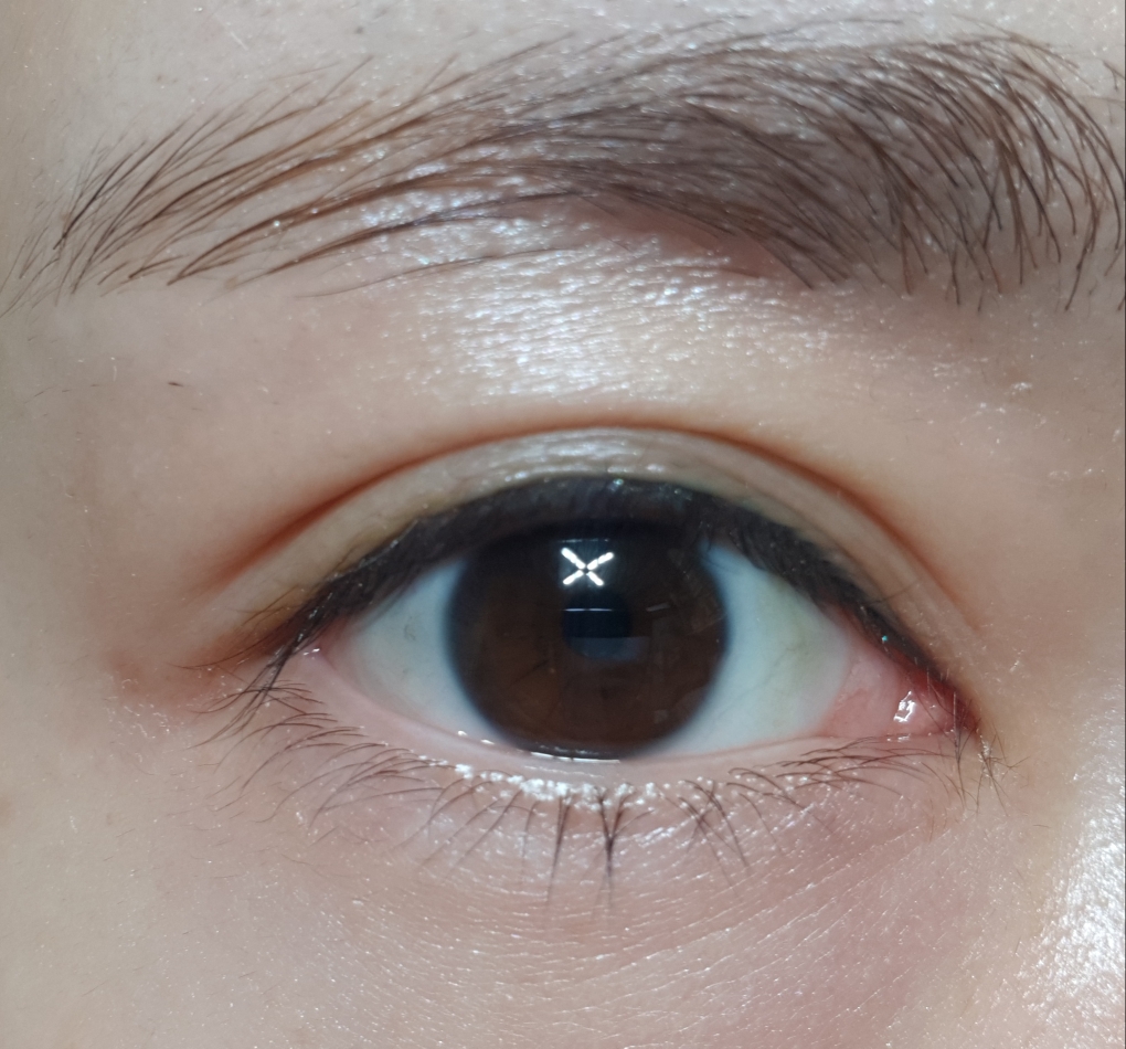 抗浮肿眼部精华啫喱的真实用户使用照片