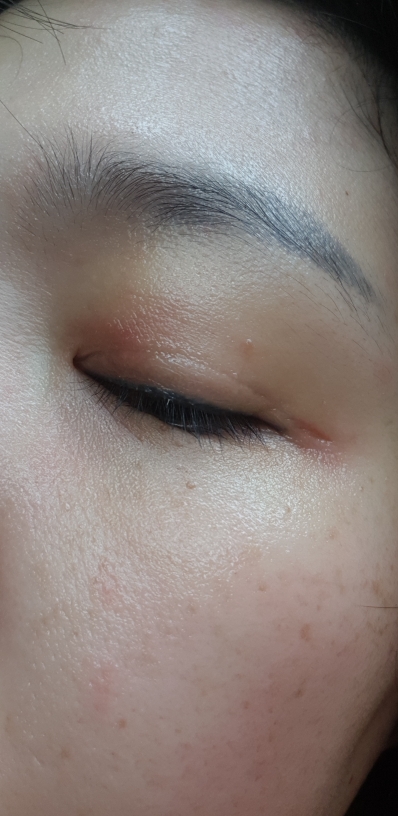 抗浮肿眼部精华啫喱的真实用户使用照片