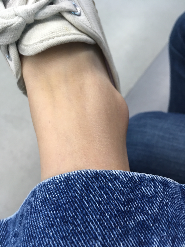 Real user review photo of Double Cut Cicastic Balm
