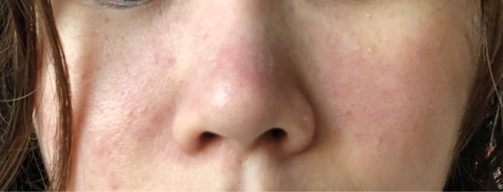 Real user review photo of Biogenic Refining Essence