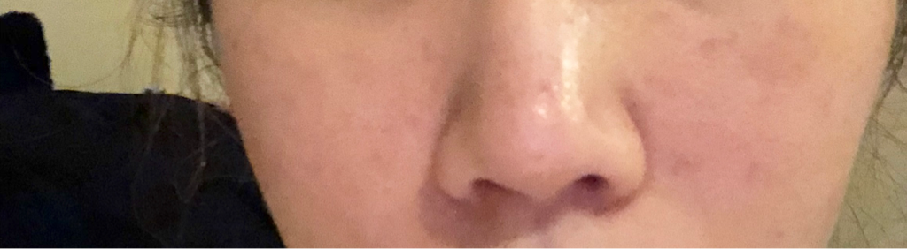 Real user review photo of Biogenic Refining Essence