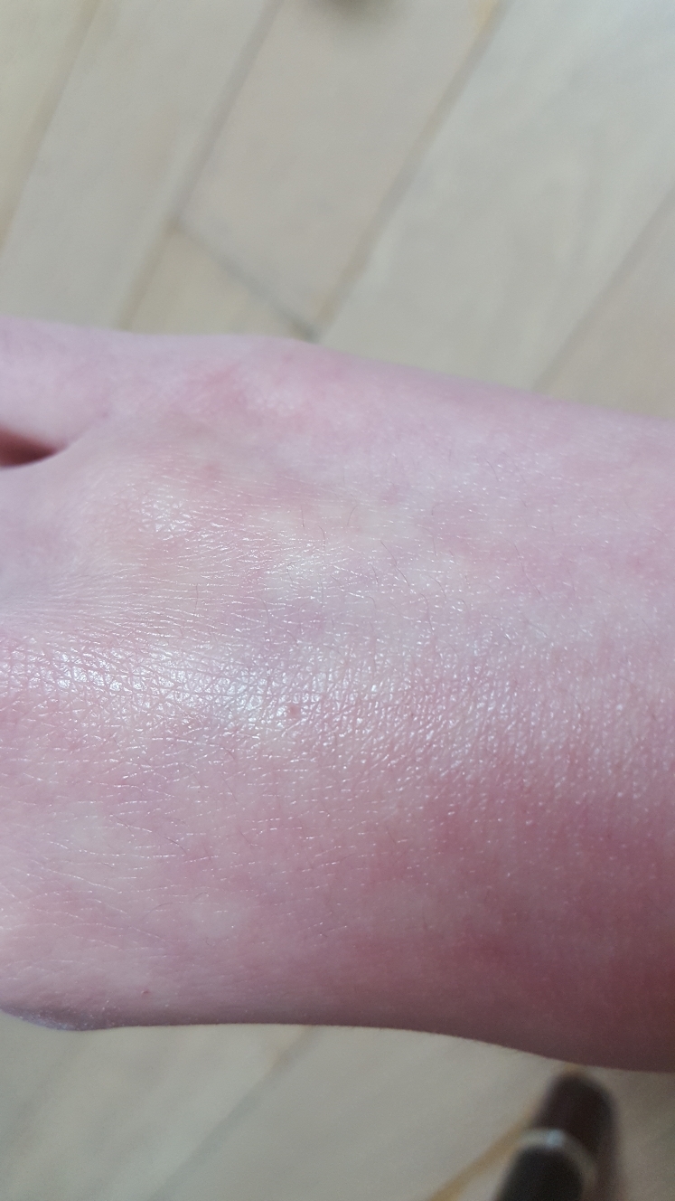 케어존 (CAREZONE) 닥터솔루션 리큐어 터닝 에센스 review image