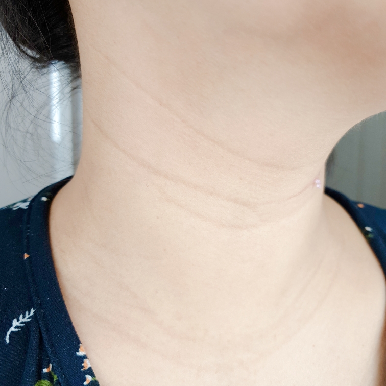 YURICA Neck and line review image
