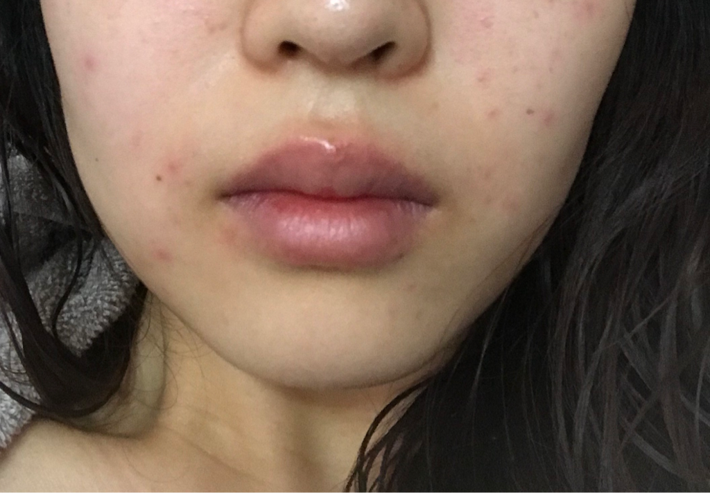 Real user review photo of 10 PM 2-step soothing mask [STEP 1 microfine photo correction sheet]