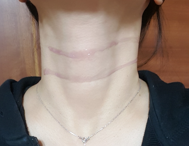 유리카 (YURICA) 넥앤라인 review image