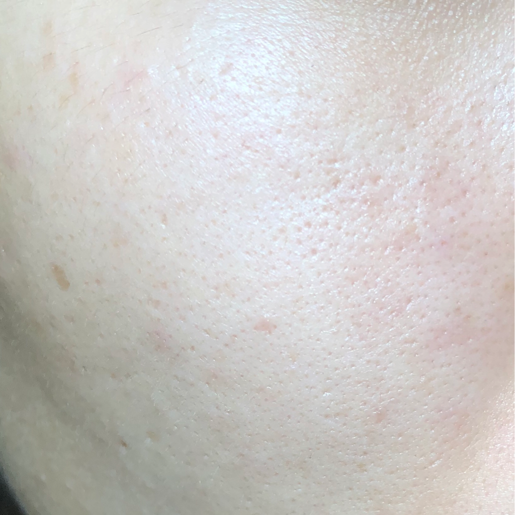 클리브 (CLⅣ) 맥스 히아루로닉 포뮬러 앰플 review image