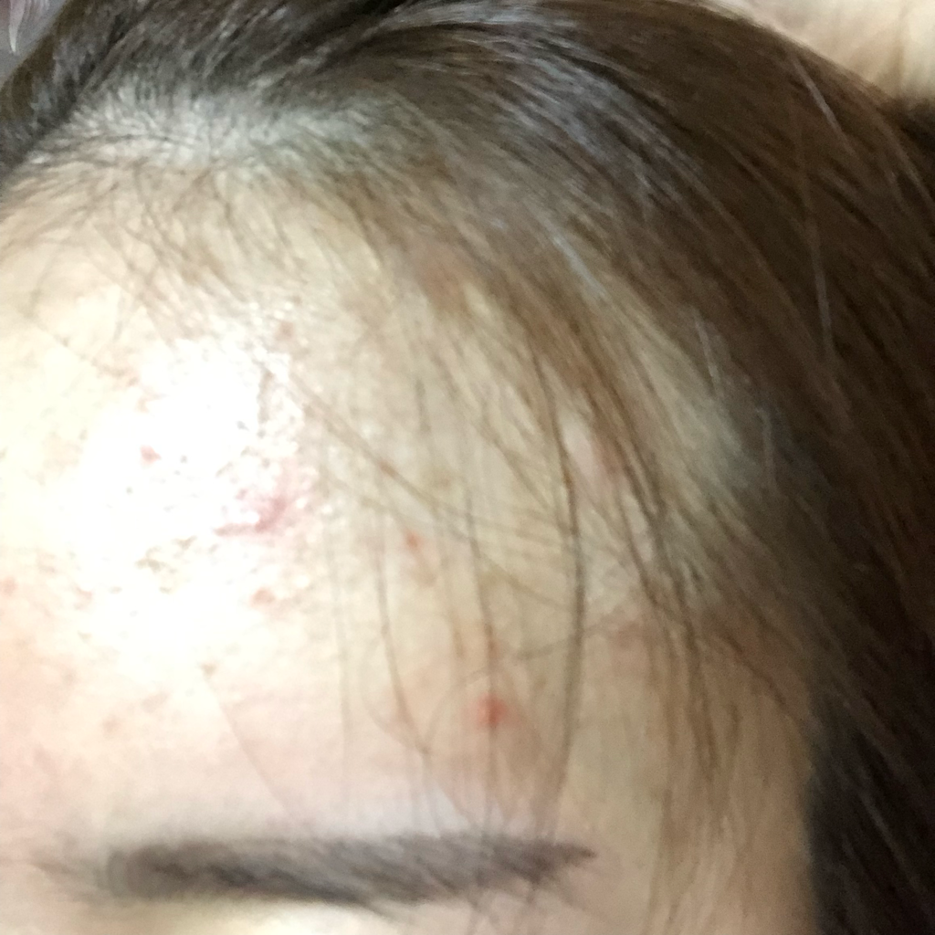 VICLE Tiak Soothing Gel Cream review image