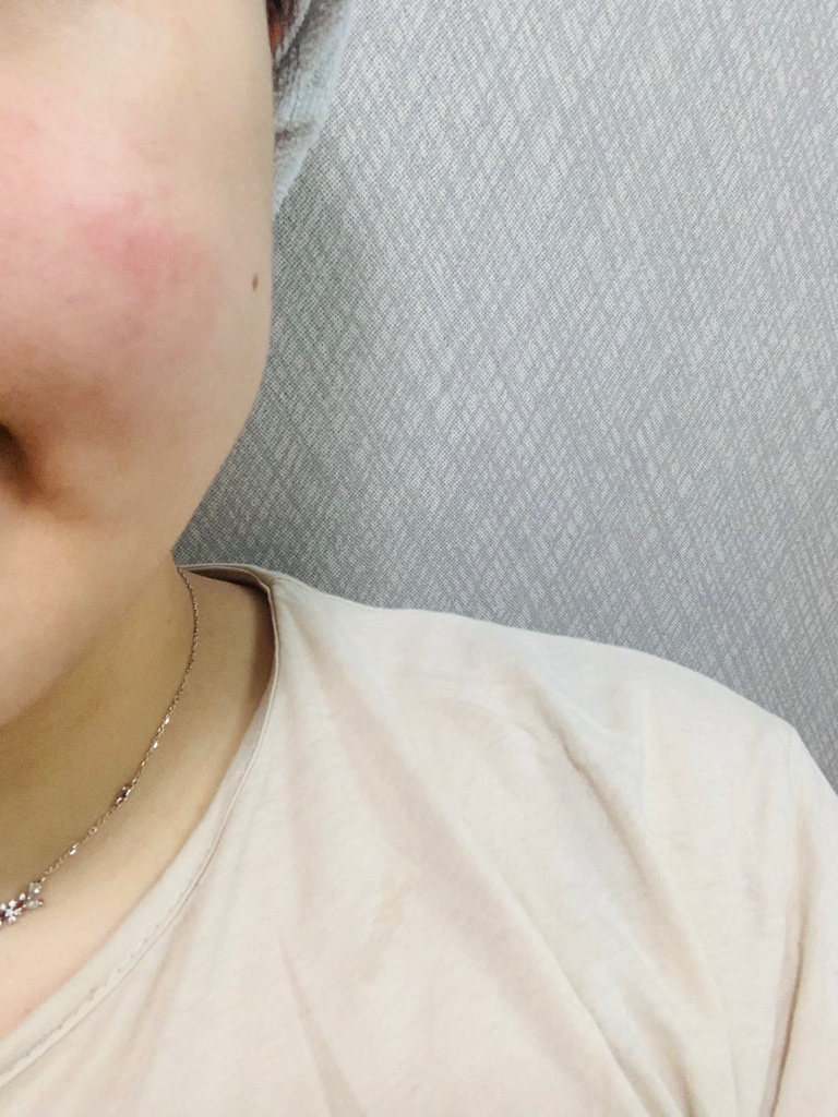 西卡罗水润乳霜的真实用户使用照片