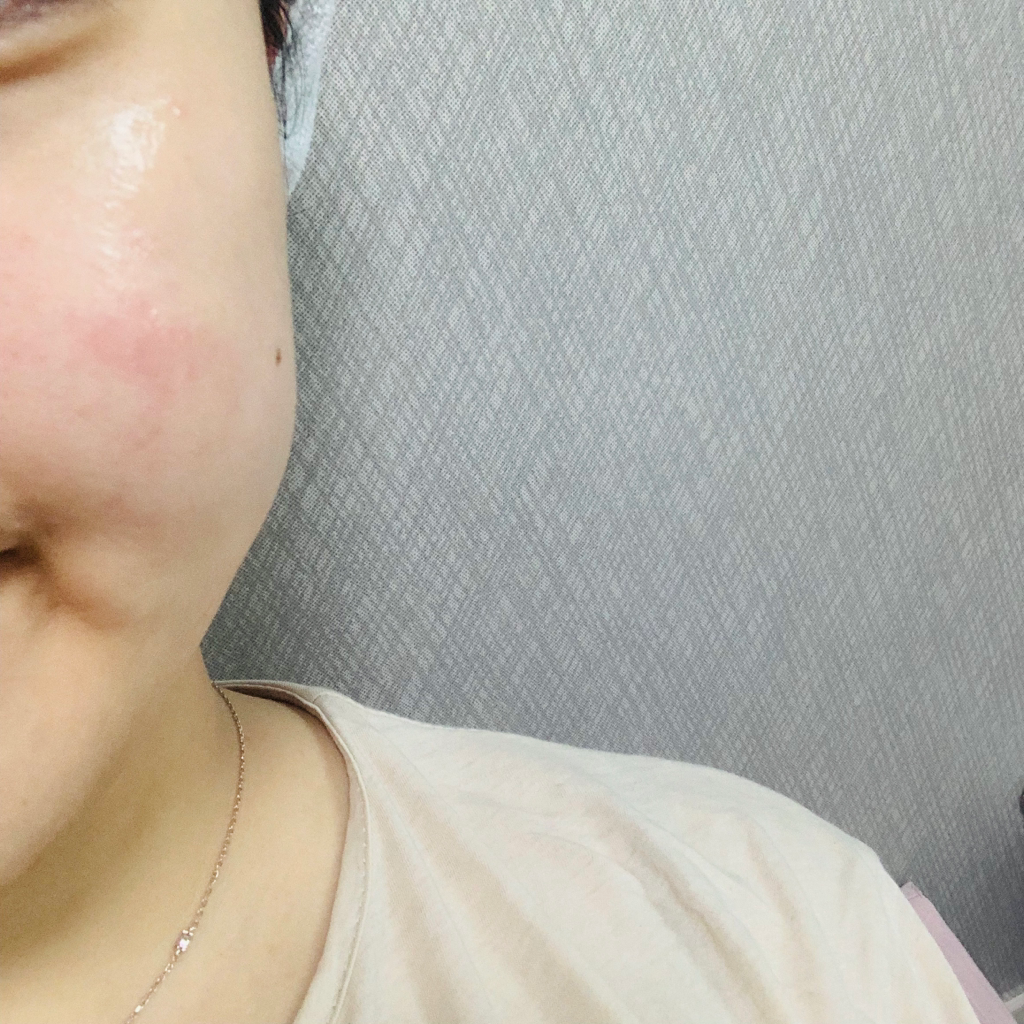 西卡罗水润乳霜的真实用户使用照片