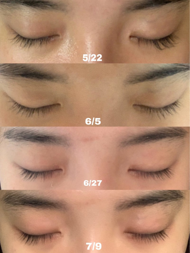 에이페 (epais) 아이래쉬 리치 세럼 review image