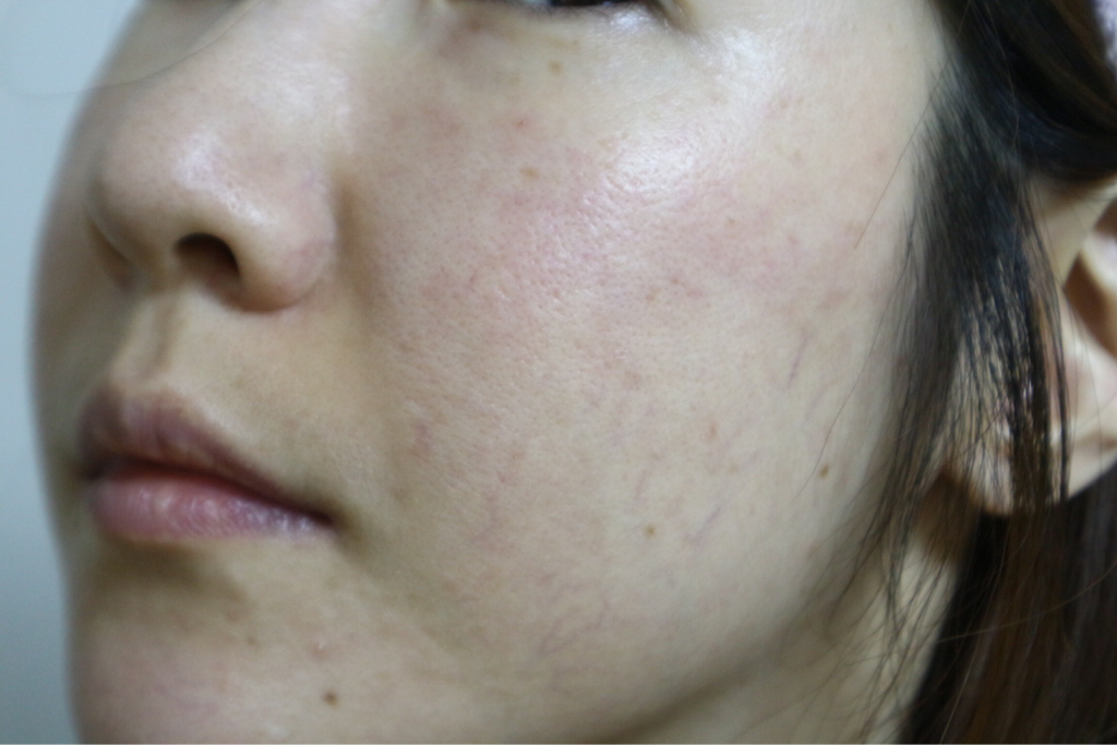 huangjisoo 绿鱼子精华舒适平衡爽肤水 common.review image