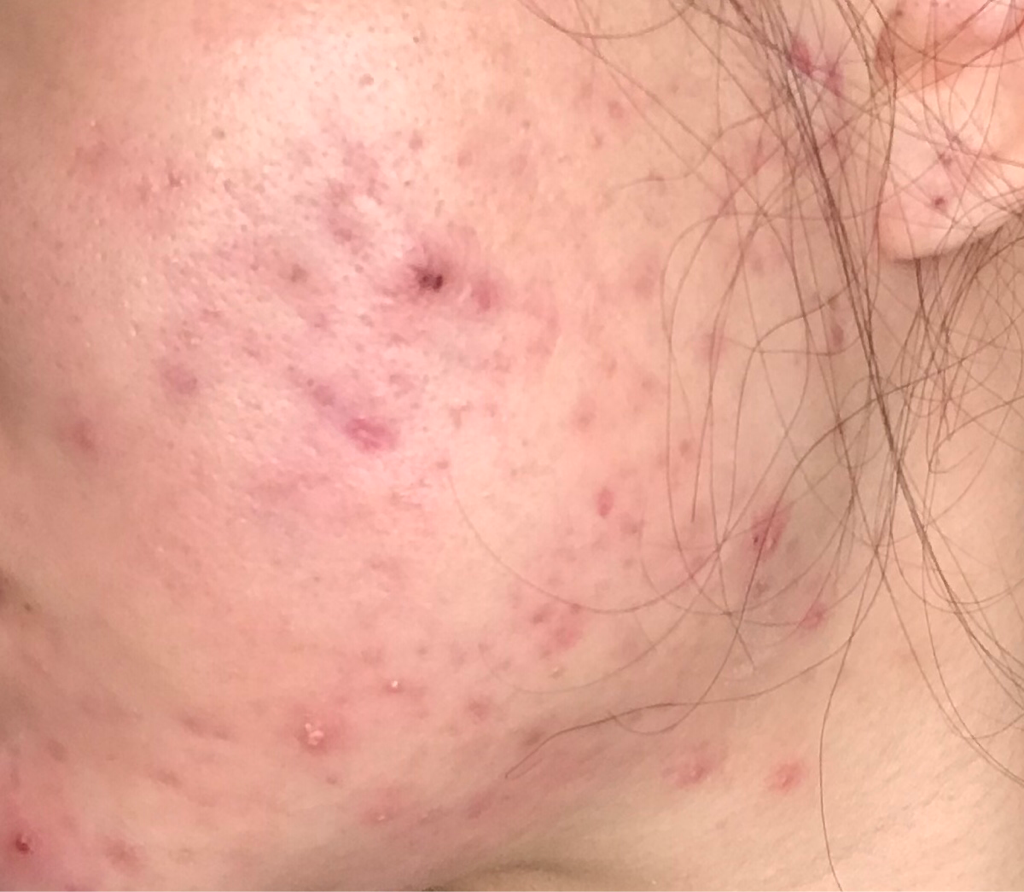 Real user review photo of From Ganghwa Clear Wormwood Deep Night Sleeping Pack
