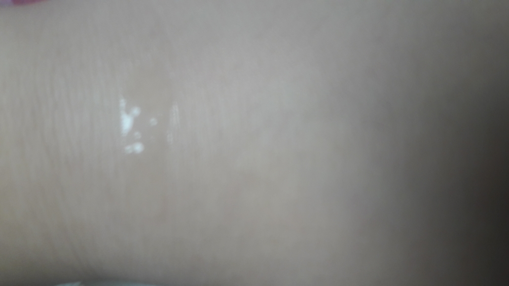 茶树精油 20的真实用户使用照片